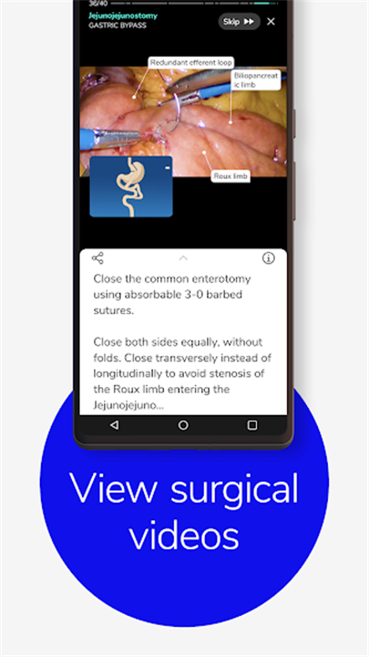 Touch Surgery: Surgical Videos screenshot6