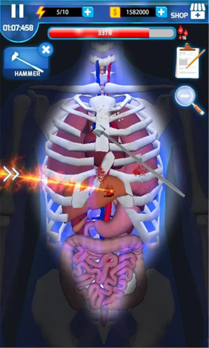 Surgery Master screenshot2